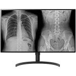LG DIAGNOSTIC 32HL512D-M, 31.5" 32HL512D-M