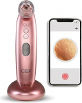 GESS Sleek Blackhead eemaldaja ja pooride tolmuimeja koos kaameraga n&auml;opuhasti akne jaoks Comedone Lifter Care 4 vahetatavat lisaseadet USB laadimisjaama