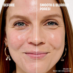 The Porefessional Foundation