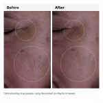 Growth Factors Solution 15% Serum