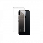 Kaitse&uuml;mbris X-Ray, Xiaomi Redmi 15C, l&auml;bipaistev, CARE by PanzerGlass