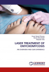 LASER TREATMENT OF ONYCHOMYCOSIS: AN OVERVIEW AND OUR EXPERIENCE