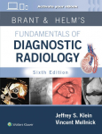 Brant & Helms Fundamentals of Diagnostic Radiology: Print + eBook with Multimedia