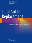 Total Ankle Replacement: A Practical Guide to Surgical Management