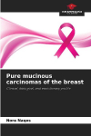 Pure mucinous carcinomas of the breast: Clinical, biological, and evolutionary profile