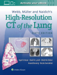 Webb, Muller and Naidichs High Resolution of Lung CT