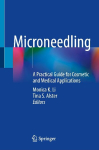 Microneedling: A Practical Guide for Cosmetic and Medical Applications