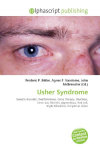 Usher Syndrome: Genetic disorder, Deafblindness, Gene therapy, Deafness, Inner ear,    Retinitis pigmentosa, Rod cell, Night blindness, Peripheral vision