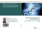 Epigenetic biomarkers in colorectal cancer: Novel epigenetic biomarkers for diagnosis, prognosis and response prediction in colorectal cancer
