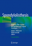 Spondylolisthesis: Diagnosis, Non-Surgical Management, and Surgical Techniques