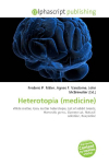 Heterotopia (medicine):     White matter, Gray matter heterotopia, List of rabbit breeds, Homeotic    genes, Siamese cat, Natural selection, Exaptation