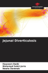 Jejunal Diverticulosis