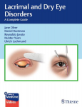 Lacrimal and Dry Eye Disorders: A Complete Guide