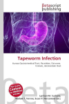 Tapeworm Infection: Human Gastrointestinal Tract, Parasitism, Flatworm, Cestoda, Intermediate Host