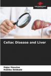Celiac Disease and Liver
