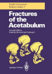 Fractures of the Acetabulum