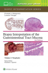 Biopsy Interpretation of the Gastrointestinal Tract Mucosa Volume 2: Neoplastic: Print + eBook with Multimedia