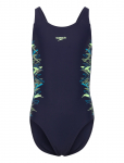 Speedo - Placement Muscleback One Piece - Ujumisriided - 164