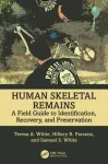 Human Skeletal Remains