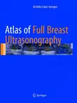 Atlas of Full Breast Ultrasonography