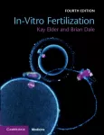 In-Vitro Fertilization
