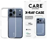 CARE by PanzerGlass X-Ray telefoni &uuml;mbris iPhone 18 Pro | iPhone 17 Pro l&auml;bipaistev
