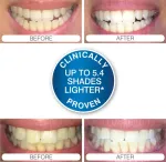 Rio DCWU-EU/1,6 USB Teeth Whitening